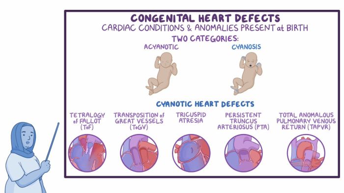 Congenital heart defects nclex questions