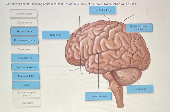 Correctly label the following anatomical features of the oral cavity