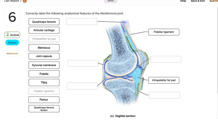 Correctly anatomical neuroglia astrocyte ependymal neurons myelinated axon